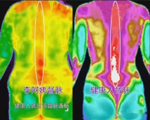 紅外熱成像可以看?。苛私庖幌箩t(yī)療診斷應(yīng)用